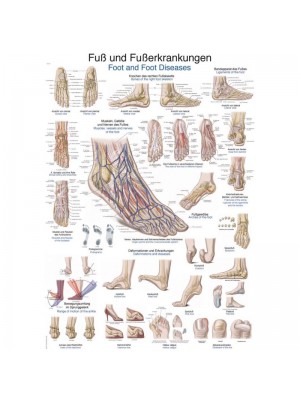 Plakat, Fod og fodsygdomme, 50x70 cm, B2-format